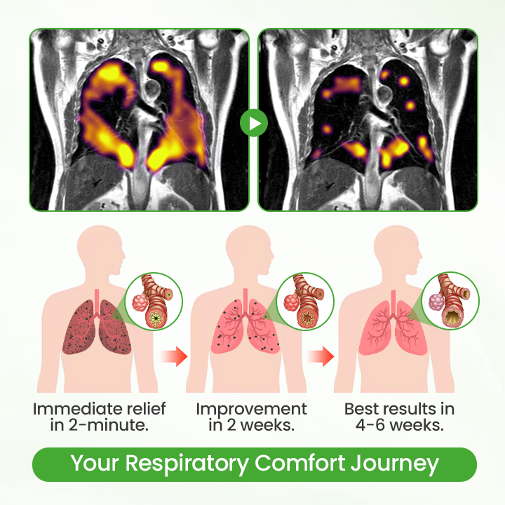 ✨NATRAVOR® HerbaAir Mullein Lung Purifier