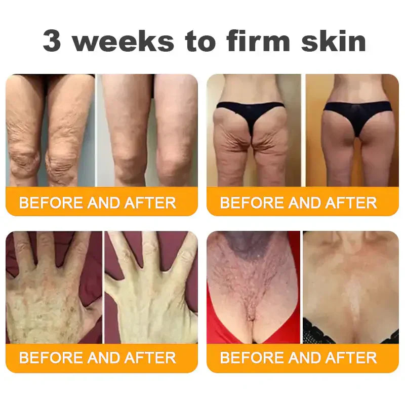 NATRAVOR® 𝐁𝐞𝐞 𝐕𝐞𝐧𝐨𝐦 𝐀𝐥𝐥-𝐢𝐧-𝐎𝐧𝐞 𝐂𝐫𝐞𝐚𝐦–🌸 Anti-aging,Hydrating, Skin Repair, Even Tone, Acne and Dark Spot Treatment, Wart and Mole Removal, Psoriasis Relief