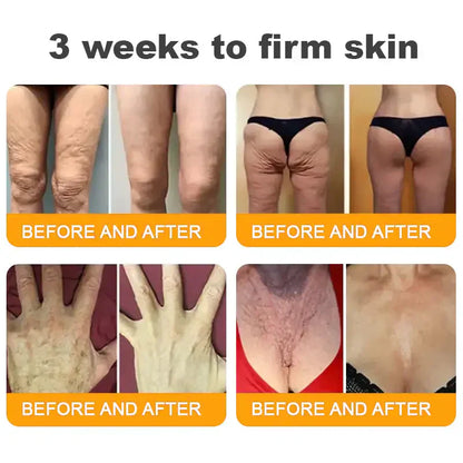 NATRAVOR® 𝐁𝐞𝐞 𝐕𝐞𝐧𝐨𝐦 𝐀𝐥𝐥-𝐢𝐧-𝐎𝐧𝐞 𝐂𝐫𝐞𝐚𝐦–🌸 Anti-aging,Hydrating, Skin Repair, Even Tone, Acne and Dark Spot Treatment, Wart and Mole Removal, Psoriasis Relief