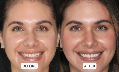 NATRAVOR® Teeth Armor Drops